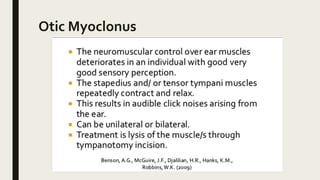 Otic Myoclonus
 