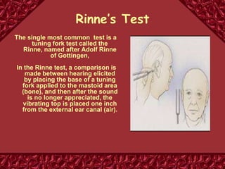 Rinne’s Test
The single most common test is a
tuning fork test called the
Rinne, named after Adolf Rinne
of Gottingen,
In the Rinne test, a comparison is
made between hearing elicited
by placing the base of a tuning
fork applied to the mastoid area
(bone), and then after the sound
is no longer appreciated, the
vibrating top is placed one inch
from the external ear canal (air).
 