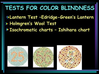 TESTS FOR COLOR BLINDNESS
• Lantern Test –Edridge-Green’s Lantern
• Holmgren’s Wool Test
• Isochromatic charts – Ishihara chart
 
