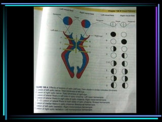 AUDITORY PATHWAY anatomy and physiologys