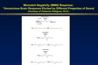 Mismatch Negativity (MMN) Response:
“Unconcious Brain Response Elicited by Different Properties of Sound
                  (Courtesy of Catharine Pettigrew, Ph.D.)
 