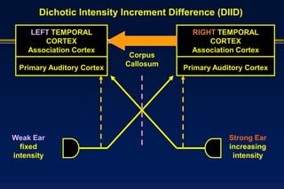 Dichotic Intensity Increment Difference (DIID)

     LEFT TEMPORAL                       RIGHT TEMPORAL
        CORTEX                               CORTEX
    Association Cortex                   Association Cortex
                            Corpus
                           Callosum
 Primary Auditory Cortex               Primary Auditory Cortex




Weak Ear                                           Strong Ear
  fixed                                            increasing
intensity                                           intensity
 