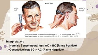 Auditory screening Test-procedure for nurses.pdf
