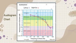 Auditory screening Test-procedure for nurses.pdf