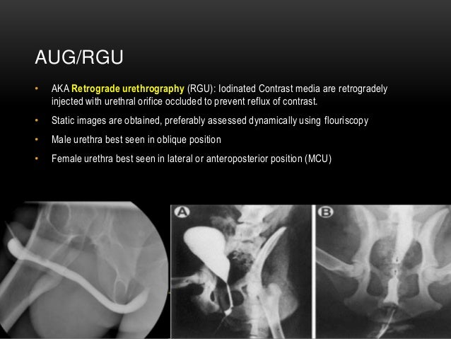 ASCENDING URETHROGRAM PROCEDURE PDF