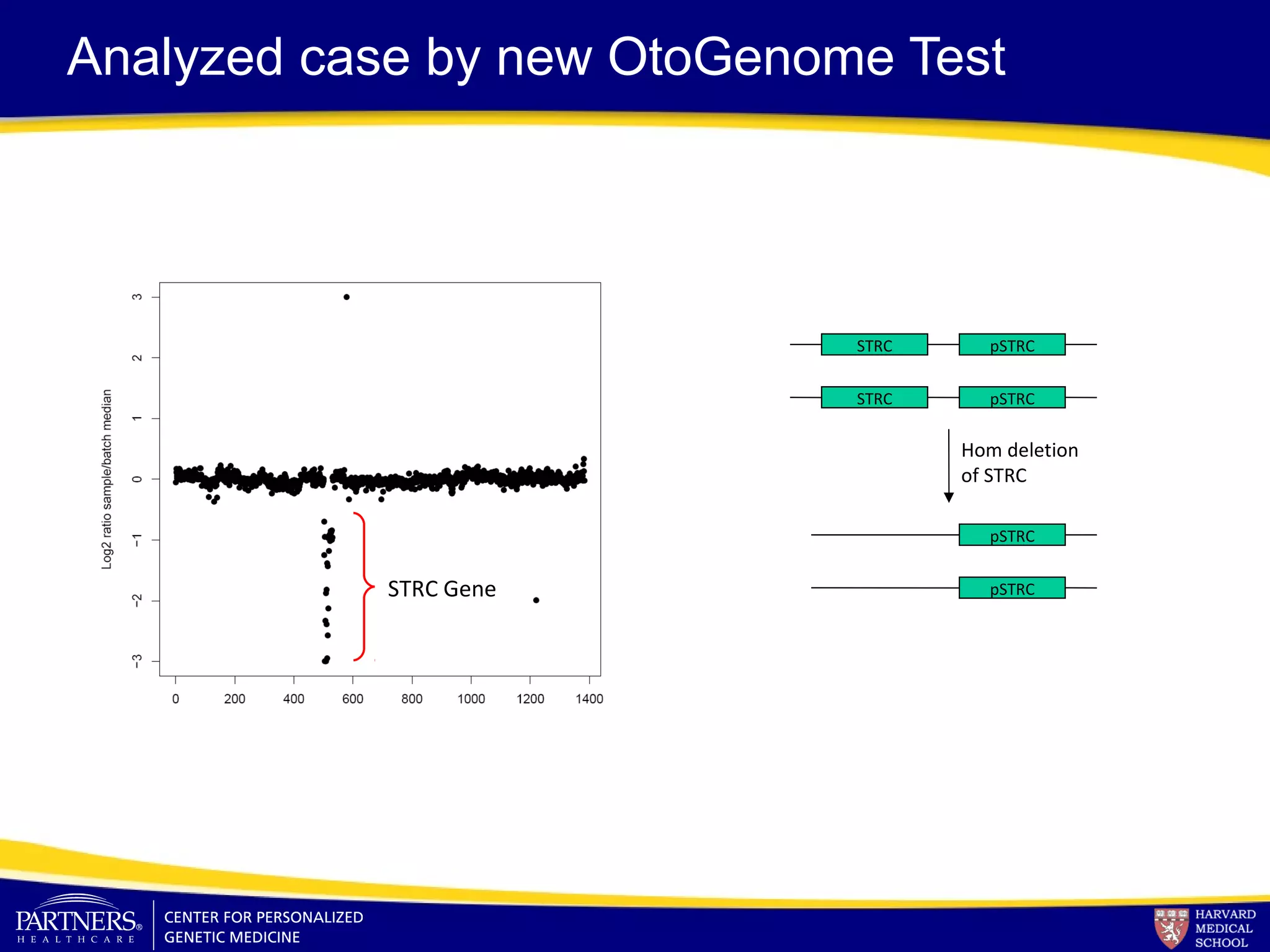 Analyzed case by new OtoGenome Test
STRC pSTRC
STRC pSTRC
Hom deletion
of STRC
pSTRC
pSTRCSTRC Gene
 