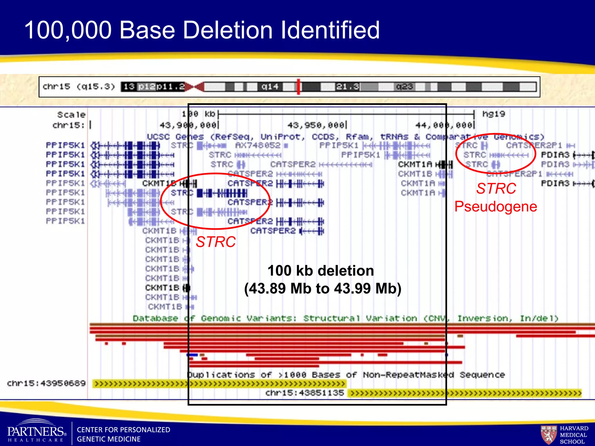 100 kb deletion
(43.89 Mb to 43.99 Mb)
STRC
Pseudogene
STRC
100,000 Base Deletion Identified
 