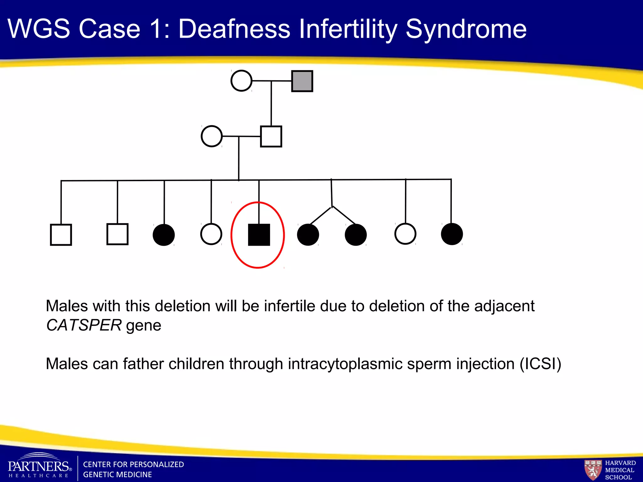 WGS Case 1: Deafness Infertility Syndrome
Males with this deletion will be infertile due to deletion of the adjacent
CATSPER gene
Males can father children through intracytoplasmic sperm injection (ICSI)
 