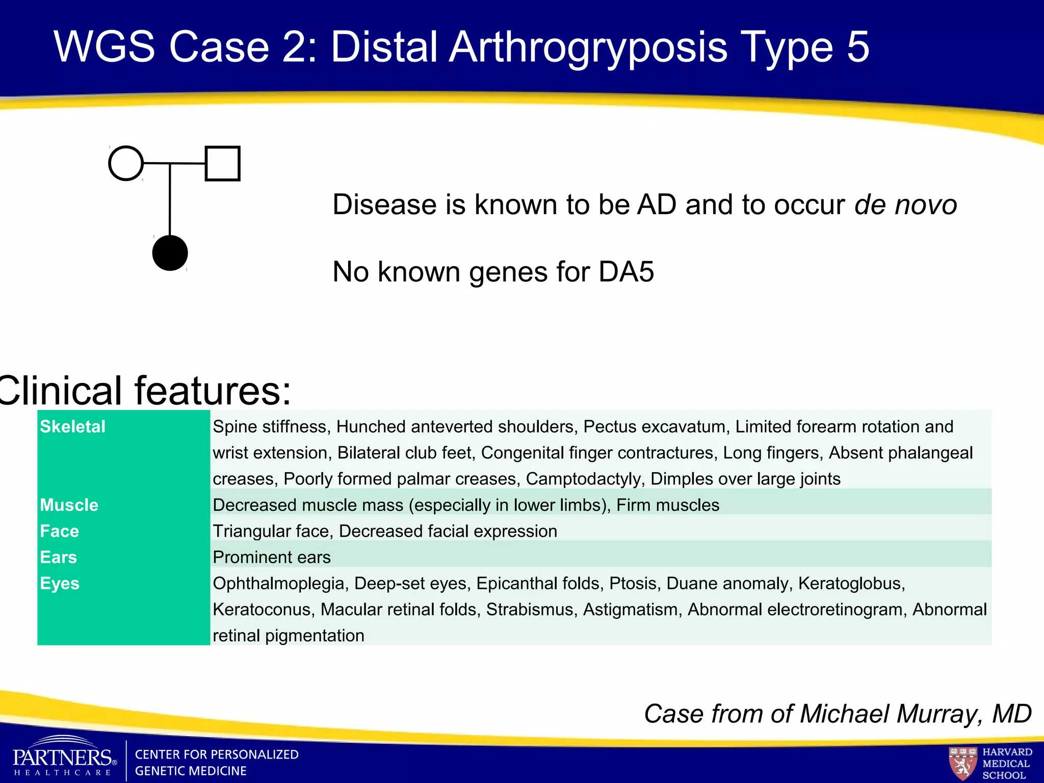WGS Case 2: Distal Arthrogryposis Type 5
Disease is known to be AD and to occur de novo
No known genes for DA5
Skeletal Spine stiffness, Hunched anteverted shoulders, Pectus excavatum, Limited forearm rotation and
wrist extension, Bilateral club feet, Congenital finger contractures, Long fingers, Absent phalangeal
creases, Poorly formed palmar creases, Camptodactyly, Dimples over large joints
Muscle Decreased muscle mass (especially in lower limbs), Firm muscles
Face Triangular face, Decreased facial expression
Ears Prominent ears
Eyes Ophthalmoplegia, Deep-set eyes, Epicanthal folds, Ptosis, Duane anomaly, Keratoglobus,
Keratoconus, Macular retinal folds, Strabismus, Astigmatism, Abnormal electroretinogram, Abnormal
retinal pigmentation
Clinical features:
Case from of Michael Murray, MD
 