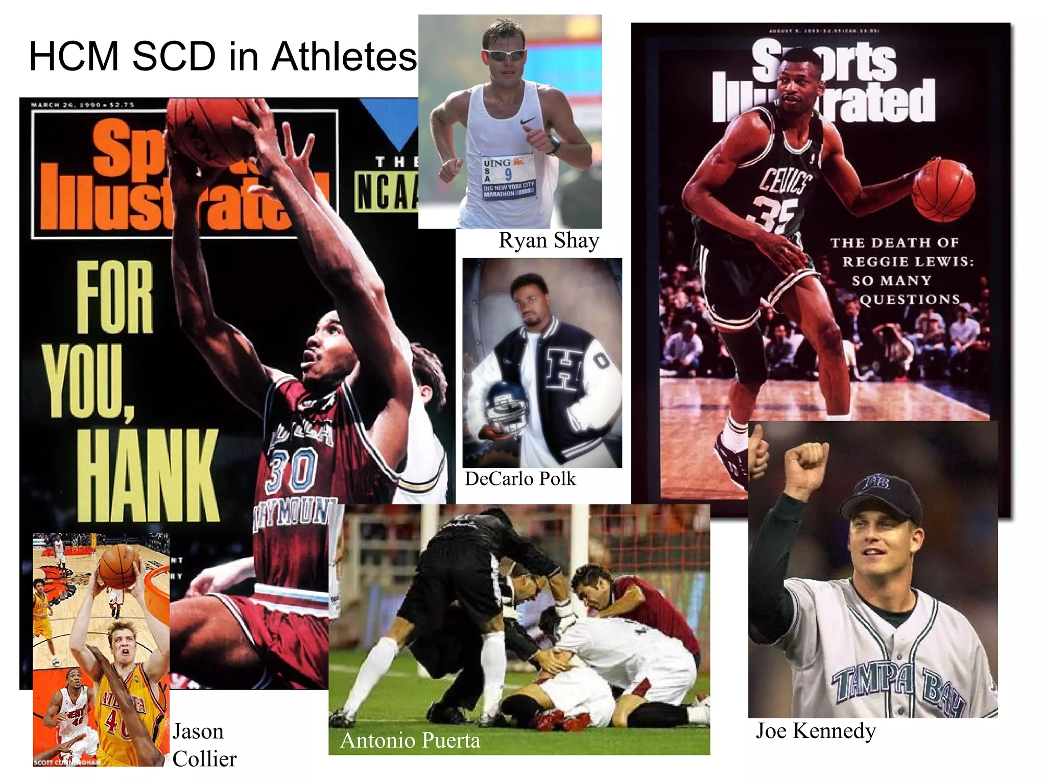 Ryan Shay
Antonio Puerta
DeCarlo Polk
Joe KennedyJason
Collier
HCM SCD in Athletes
 