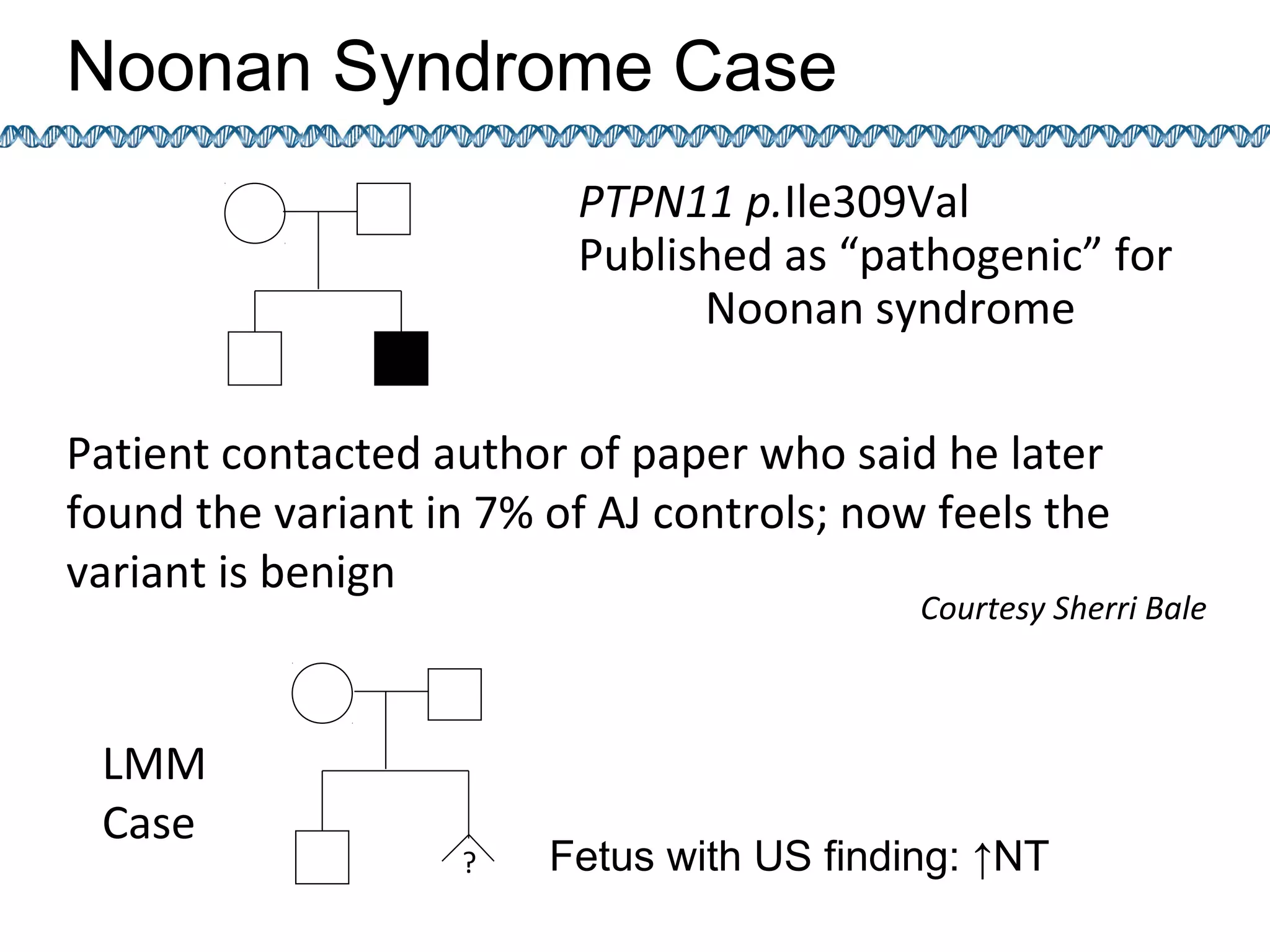 Fetus with US finding: ↑NT
PTPN11 p.Ile309Val
Published as “pathogenic” for
Noonan syndrome
Patient contacted author of paper who said he later
found the variant in 7% of AJ controls; now feels the
variant is benign
Courtesy Sherri Bale
Noonan Syndrome Case
?
LMM
Case
 