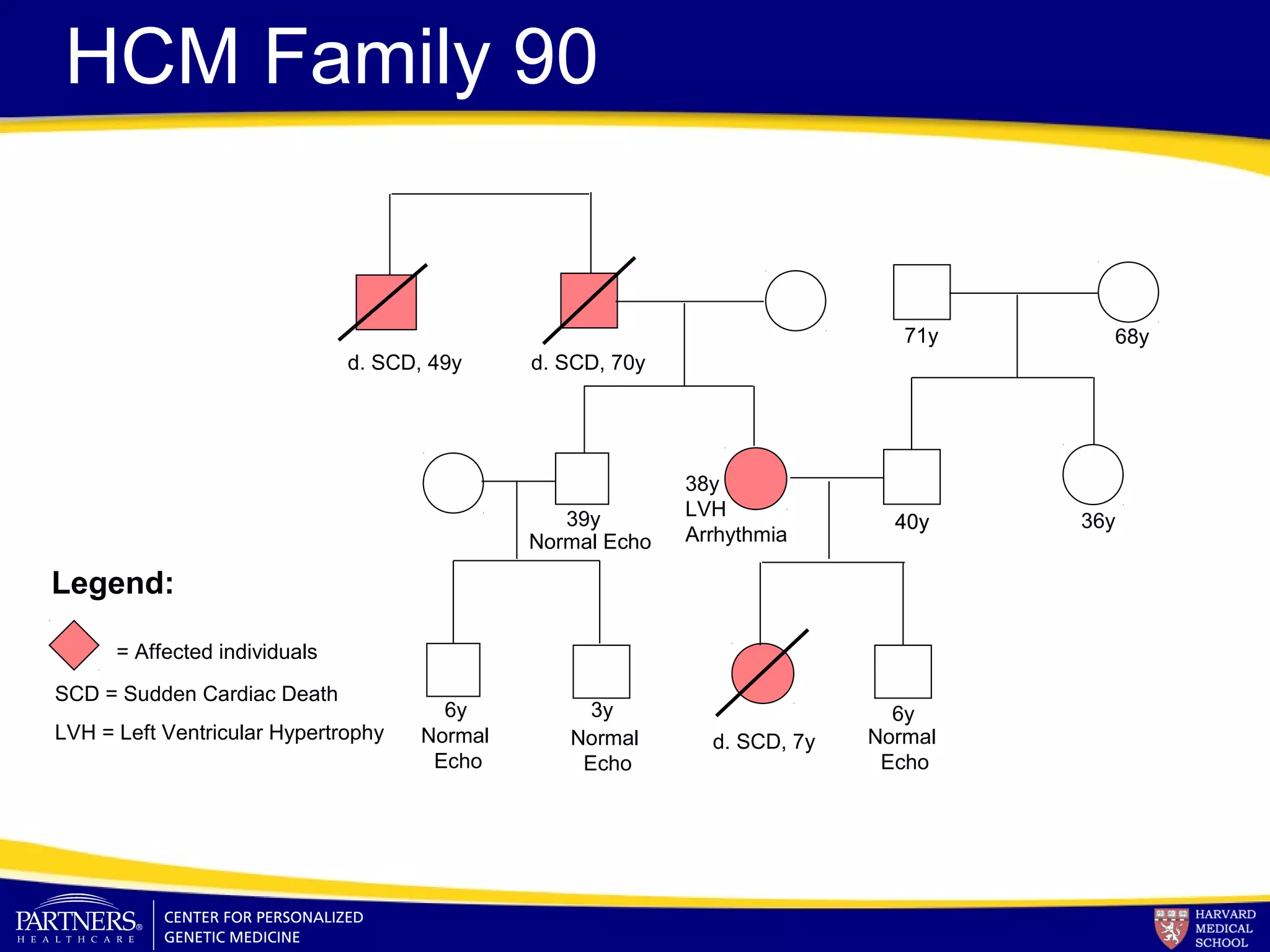HCM Family 90
Legend:
= Affected individuals
d. SCD, 49y d. SCD, 70y
39y
d. SCD, 7y
6y6y 3y
38y
LVH
Arrhythmia
SCD = Sudden Cardiac Death
LVH = Left Ventricular Hypertrophy
40y
Normal
Echo
Normal Echo
Normal
Echo
Normal
Echo
40y
71y 68y
36y
 