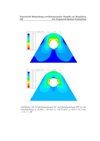½¿¾
ÆÙÑ Ö × Ò ÐÙÒ ÞÛ Ñ Ò× ÓÒ Ð Ö ÅÓ ÐÐ ÞÙÖ Ë ÑÙÐ Ø ÓÒ
Ö Ù Ò×Ø ¹ ÓÐÞ Ò¹Î Ö Ò ÙÒ
1
2
3 1
2
3
MISES VALUE
+7.97E+00
+2.13E+01
+3.47E+01
+4.80E+01
+6.14E+01
+7.48E+01
+8.81E+01
+1.01E+02
+1.15E+02
+1.28E+02
+1.42E+02
+1.55E+02
+1.68E+02
+1.82E+02
Minimum value = 7.974 at node 664
Maximum value = 181.6 at node 877
1
2
3 1
2
3
SP2 VALUE
-1.76E+01
-2.03E+00
+1.36E+01
+2.92E+01
+4.48E+01
+6.04E+01
+7.60E+01
+9.16E+01
+1.07E+02
+1.23E+02
+1.38E+02
+1.54E+02
+1.70E+02
+1.85E+02
Minimum value = -17.63 at node 936
Maximum value = 185.2 at node 877
Ð ÙÒ º ¾ Î Ö Ð ×Ô ÒÒÙÒ Ò ËÎ ÙÒ À ÙÔØ×Ô ÒÒÙÒ ËÈ¾ ÚÓÖ Ö
Ð Ò Ö ÙÒ ¸ ¼¸ Ö ¿½ ÑÑ¸ Ò ¼ Æ»ÑÑ
¾
¸ ¼¸¿ × ¼¸½ ÑÑ
¼¸ ¬ ¿¼Æ
 