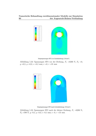 ¼
ÆÙÑ Ö × Ò ÐÙÒ ÞÛ Ñ Ò× ÓÒ Ð Ö ÅÓ ÐÐ ÞÙÖ Ë ÑÙÐ Ø ÓÒ
Ö Ù Ò×Ø ¹ ÓÐÞ Ò¹Î Ö Ò ÙÒ
SP2 VALUE
-4.47E+01
-2.55E+01
-6.44E+00
+1.27E+01
+3.18E+01
+5.09E+01
+7.00E+01
+8.91E+01
+1.08E+02
+1.27E+02
+1.46E+02
+1.66E+02
+1.85E+02
+2.04E+02
Hauptspannungen SP2 (vor Gelenkdrehung) [N/mm²]
Ð ÙÒ º¿¾ ËÔ ÒÒÙÒ Ò ËÈ¾ ÚÓÖ Ö Ö ÙÒ ¸ ½ ¾¼¼ Æ¸ ¾ ¼¸
¼¸ ¼¸¿ × ¼¸½ ÑÑ ¼¸ Ö ¿½ ÑÑ
SP2 VALUE
-3.64E+01
-1.23E+01
+1.18E+01
+3.58E+01
+5.99E+01
+8.40E+01
+1.08E+02
+1.32E+02
+1.56E+02
+1.80E+02
+2.04E+02
+2.28E+02
+2.52E+02
+2.77E+02
Hauptspannungen SP2 (nach Gelenkdrehung) [N/mm²]
Ð ÙÒ º¿¿ ËÔ ÒÒÙÒ Ò ËÈ¾ Ò Ö Ð Ò Ö Ö ÙÒ ¸ ½ ¾¼¼ Æ¸
¾ ¼¼ Æ¸ ¼¸ ¼¸¿ × ¼¸½ ÑÑ ¼¸ Ö ¿½ ÑÑ
 