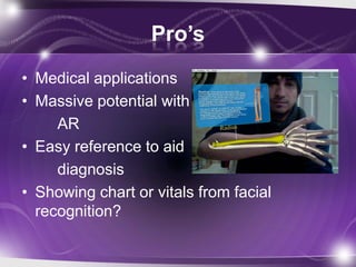 Pro’s
• Medical applications
• Massive potential with
     AR
• Easy reference to aid
     diagnosis
• Showing chart or vitals from facial
  recognition?
 