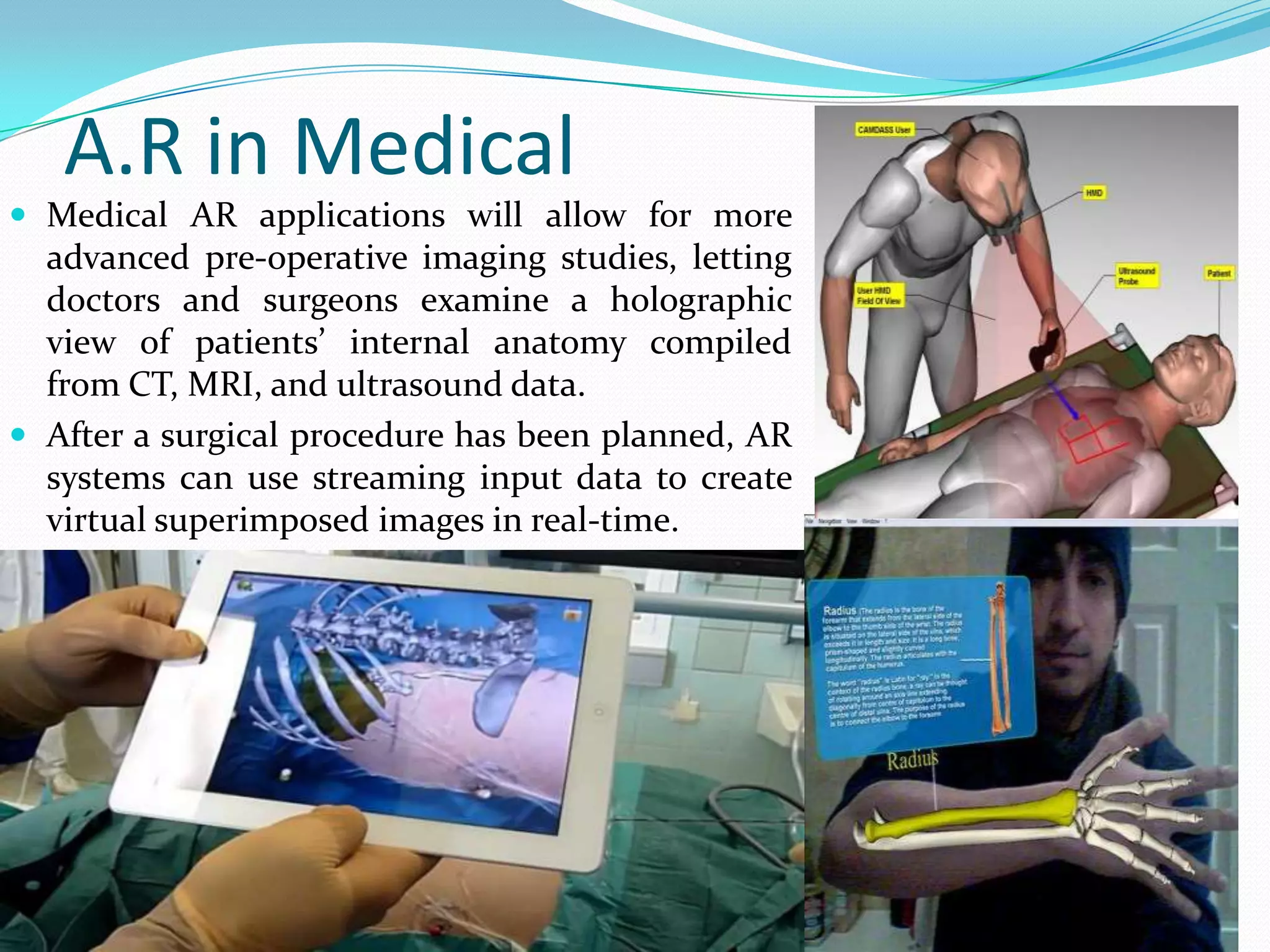 A.R in Medical
 Medical AR applications will allow for more
advanced pre-operative imaging studies, letting
doctors and surgeons examine a holographic
view of patients’ internal anatomy compiled
from CT, MRI, and ultrasound data.
 After a surgical procedure has been planned, AR
systems can use streaming input data to create
virtual superimposed images in real-time.
 