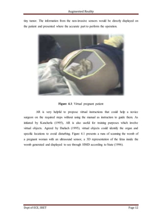 Augmented Reality
Dept of ECE, SRET Page 12
tiny tumor. The information from the non-invasive sensors would be directly displayed on
the patient and presented where the accurate part to perform the operation.
Figure 4.1: Virtual pregnant patient
AR is very helpful to propose virtual instructions that could help a novice
surgeon on the required steps without using the manual as instruction to guide them. As
initiated by Kancherla (1995), AR is also useful for training purposes which involve
virtual objects. Agreed by Durlach (1995), virtual objects could identify the organ and
specific locations to avoid disturbing. Figure 4.1 presents a runs of scanning the womb of
a pregnant woman with an ultrasound sensor, a 3D representation of the fetus inside the
womb generated and displayed to see through HMD according to State (1996).
 