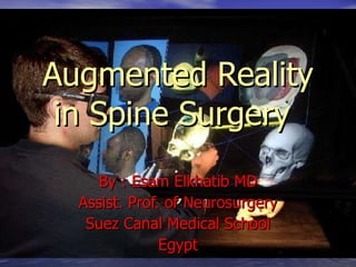 Augmented Reality in Spine Surgery   By : Esam Elkhatib MD Assist. Prof. of Neurosurgery Suez Canal Medical School Egypt 