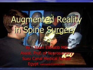 Augmented Reality in Spine Surgery   By : Esam Elkhatib MD Assist. Prof. of Neurosurgery Suez Canal Medical School Egypt . ealkhatib@yahoo.com 