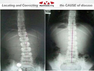 Hormonal imbalances/ thyroid prob.What’s The Solution?Step 1: Remove the Sources Step 2: Unload the Toxins from Your Body and Cells - Empty Your 70 Trillion BucketsStep 3: Bind the Toxins for Safe and Permanent Removal.