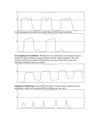 Capnography overview for ems.cole