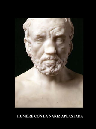 HOMBRE CON LA NARIZ APLASTADA 