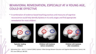 Dyslexia: a case study of everyday neurobiology | PDF