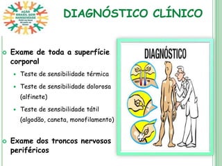 DIAGNÓSTICO CLÍNICO
 Exame de toda a superfície
corporal
 Teste de sensibilidade térmica
 Teste de sensibilidade dolorosa
(alfinete)
 Teste de sensibilidade tátil
(algodão, caneta, monofilamento)
 Exame dos troncos nervosos
periféricos
 