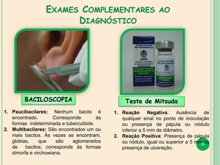 EXAMES COMPLEMENTARES AO
DIAGNÓSTICO
17
BACILOSCOPIA Teste de Mitsuda
1. Reação Negativa: Ausência de
qualquer sinal no ponto de inoculação
ou presença de pápula ou nódulo
inferior a 5 mm de diâmetro.
2. Reação Positiva: Presença de pápula
ou nódulo, igual ou superior a 5 mm ou
presença de ulceração.
1. Paucibacilares: Nenhum bacilo é
encontrado. Corresponde às
formas indeterminada e tuberculóide.
2. Multibacilares: São encontrados um ou
mais bacilos. Às vezes se encontram,
globias, que são aglomerados
de bacilos; corresponde às formas
dimorfa e virchowiana.
 