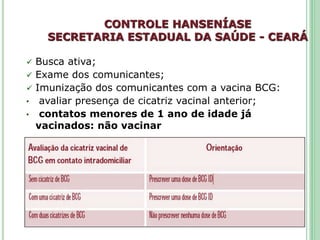 CONTROLE HANSENÍASE
SECRETARIA ESTADUAL DA SAÚDE - CEARÁ
 Busca ativa;
 Exame dos comunicantes;
 Imunização dos comunicantes com a vacina BCG:
• avaliar presença de cicatriz vacinal anterior;
• contatos menores de 1 ano de idade já
vacinados: não vacinar
 