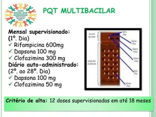 PQT MULTIBACILAR
Mensal supervisionado:
(1º. Dia)
 Rifampicina 600mg
 Dapsona 100 mg
 Clofazimina 300 mg
Diário auto-administrado:
(2º. ao 28º. Dia)
 Dapsona 100 mg
 Clofazimina 50 mg
Critério de alta: 12 doses supervisionadas em até 18 meses
 