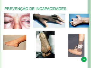 PREVENÇÃO DE INCAPACIDADES
26
 