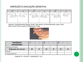 INSPEÇÃO E AVALIAÇÃO SENSITIVA
Legenda: N = normal E = espessado D = dor
 