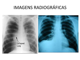 IMAGENS RADIOGRÁFICAS
 