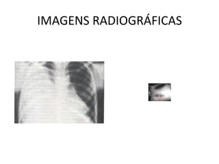 IMAGENS RADIOGRÁFICAS
 