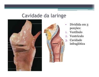 Cavidade da laringe
• Dividida em 3
porções:
1. Vestíbulo
2. Ventrículo
3. Cavidade
infraglótica
 