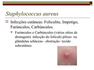 Staphylococcus aureus
 Infecções cutâneas: Foliculite, Impetigo,
Furúnculos, Carbúnculos.
 Furúnculos e Carbúnculos (vários sítios de
drenagem): infecção do folículo piloso ou
glândulas sebáceas– obstrução- tecido
subcutâneo.
 