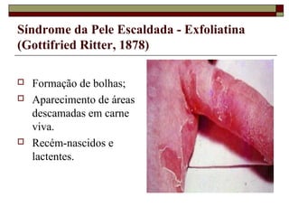 Síndrome da Pele Escaldada - Exfoliatina
(Gottifried Ritter, 1878)
 Formação de bolhas;
 Aparecimento de áreas
descamadas em carne
viva.
 Recém-nascidos e
lactentes.
 