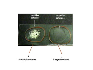 Staphylococcus
+
Streptococcus
-
 