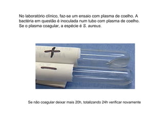 No laboratório clínico, faz-se um ensaio com plasma de coelho. A
bactéria em questão é inoculada num tubo com plasma de coelho.
Se o plasma coagular, a espécie é S. aureus.
Se não coagular deixar mais 20h, totalizando 24h verificar novamente
 