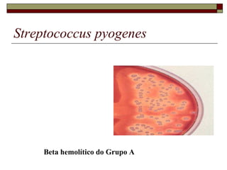 Streptococcus pyogenes
Beta hemolítico do Grupo A
 