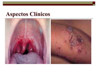 Aspectos Clínicos
 
