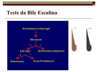 Teste da Bile Esculina
 