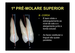 1º PRÉ-MOLARE SUPERIOR
B - COROA
• É bem nítido o
estrangulamento ao
nível de colo e o
alargamento junto a
borda oclusal;
• As faces vestibular e
lingual são quase
paralelas.
 