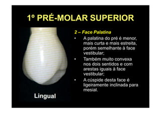 1º PRÉ-MOLAR SUPERIOR
2 – Face Palatina
• A palatina do pré é menor,
mais curta e mais estreita,
porém semelhante à face
vestibular;
• Também muito convexa
nos dois sentidos e com
arestas iguais à face
vestibular;
• A cúspide desta face é
ligeiramente inclinada para
mesial.
 