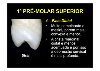 1º PRÉ-MOLAR SUPERIOR
4 – Face Distal
• Muito semelhante a
mesial, porém mais
convexa e menor.
• A crista marginal
distal é menos
acentuada e por isso
a depressão cervical
é mais profunda.
 