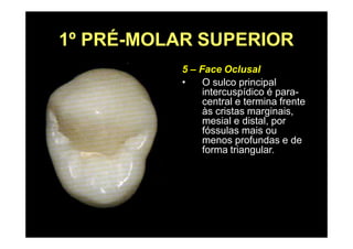 1º PRÉ-MOLAR SUPERIOR
5 – Face Oclusal
• O sulco principal
intercuspídico é para-
central e termina frente
às cristas marginais,
mesial e distal, por
fóssulas mais ou
menos profundas e de
forma triangular.
 