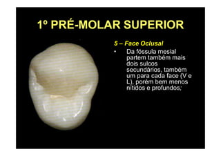 1º PRÉ-MOLAR SUPERIOR
5 – Face Oclusal
• Da fóssula mesial
partem também mais
dois sulcos
secundários, também
um para cada face (V e
L), porém bem menos
nítidos e profundos;
 