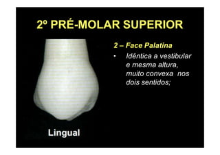 2º PRÉ-MOLAR SUPERIOR
2 – Face Palatina
• Idêntica a vestibular
e mesma altura,
muito convexa nos
dois sentidos;
 
