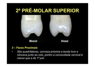 2º PRÉ-MOLAR SUPERIOR
3 – Faces Proximais
• São quadriláteras, convexa próxima a borda livre e
côncava junto ao colo, porém a concavidade cervical é
menor que a do 1º pré.
 